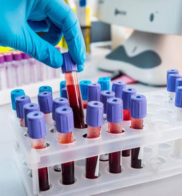 DOCÊNCIA DO ENSINO SUPERIOR E HEMATOLOGIA DOCÊNCIA DO ENSINO SUPERIOR E HEMATOLOGIA